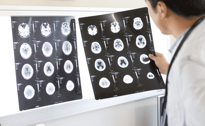 【脳神経外科】失敗しない開業ポイント・年収や開業資金も解説